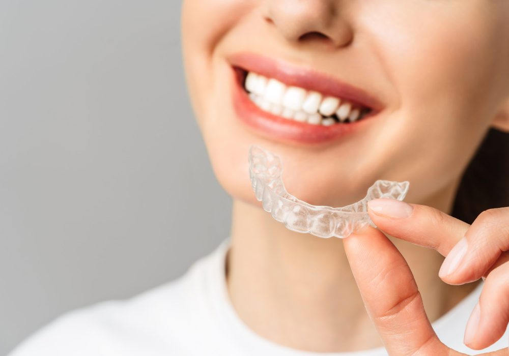 A young woman does a home teeth whitening procedure. Whitening tray with gel.